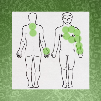 Гирудотерапия в комплексном лечении ишемии при сердечно-сосудистых заболеваниях